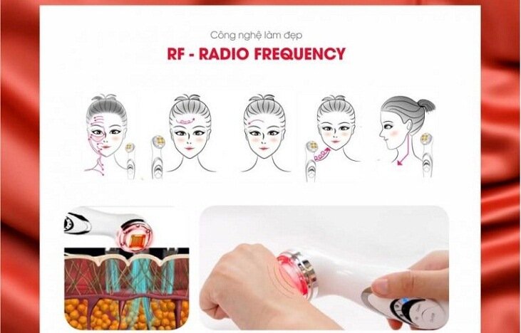 Công nghệ sóng RF